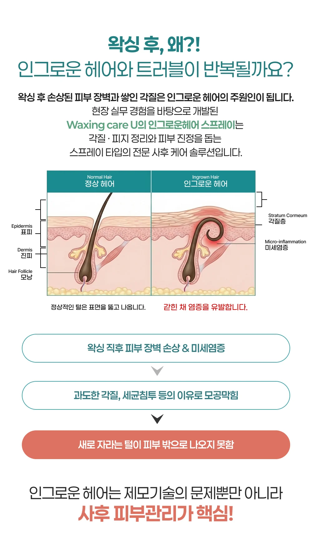인그로운헤어